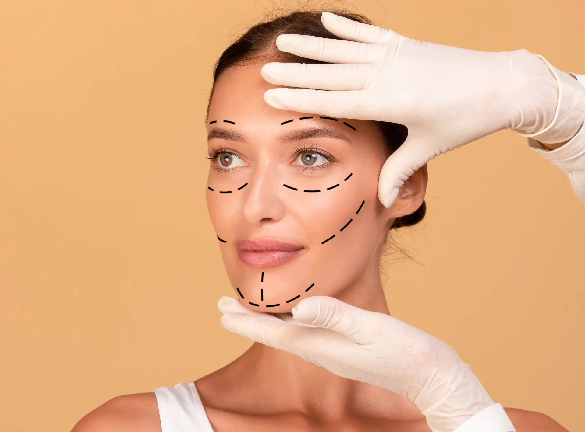 Having a Facelift by Dr. Perfect Celebrity