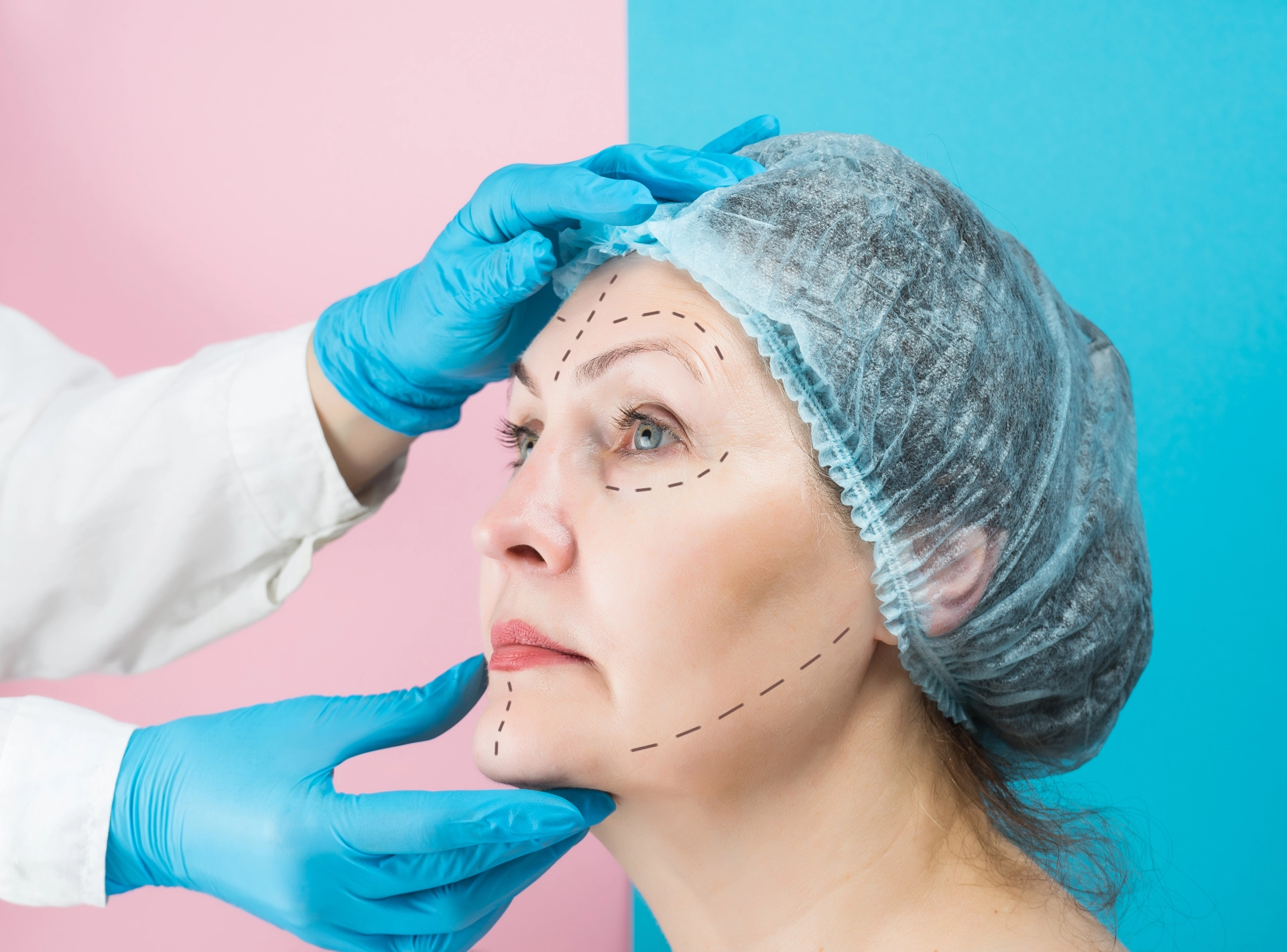 Will I Look Different After Facelift?