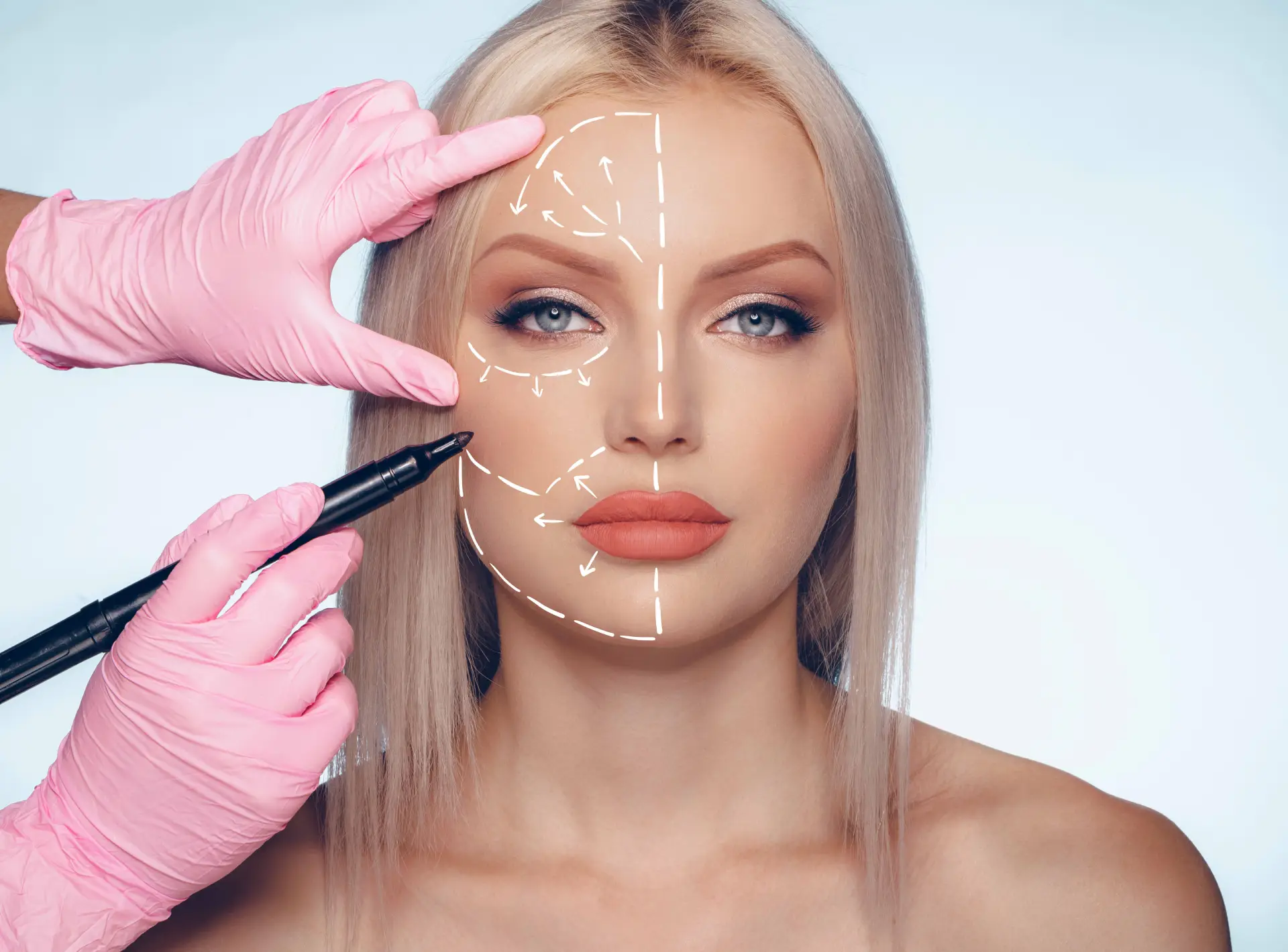 Benefits of Facelift Surgery