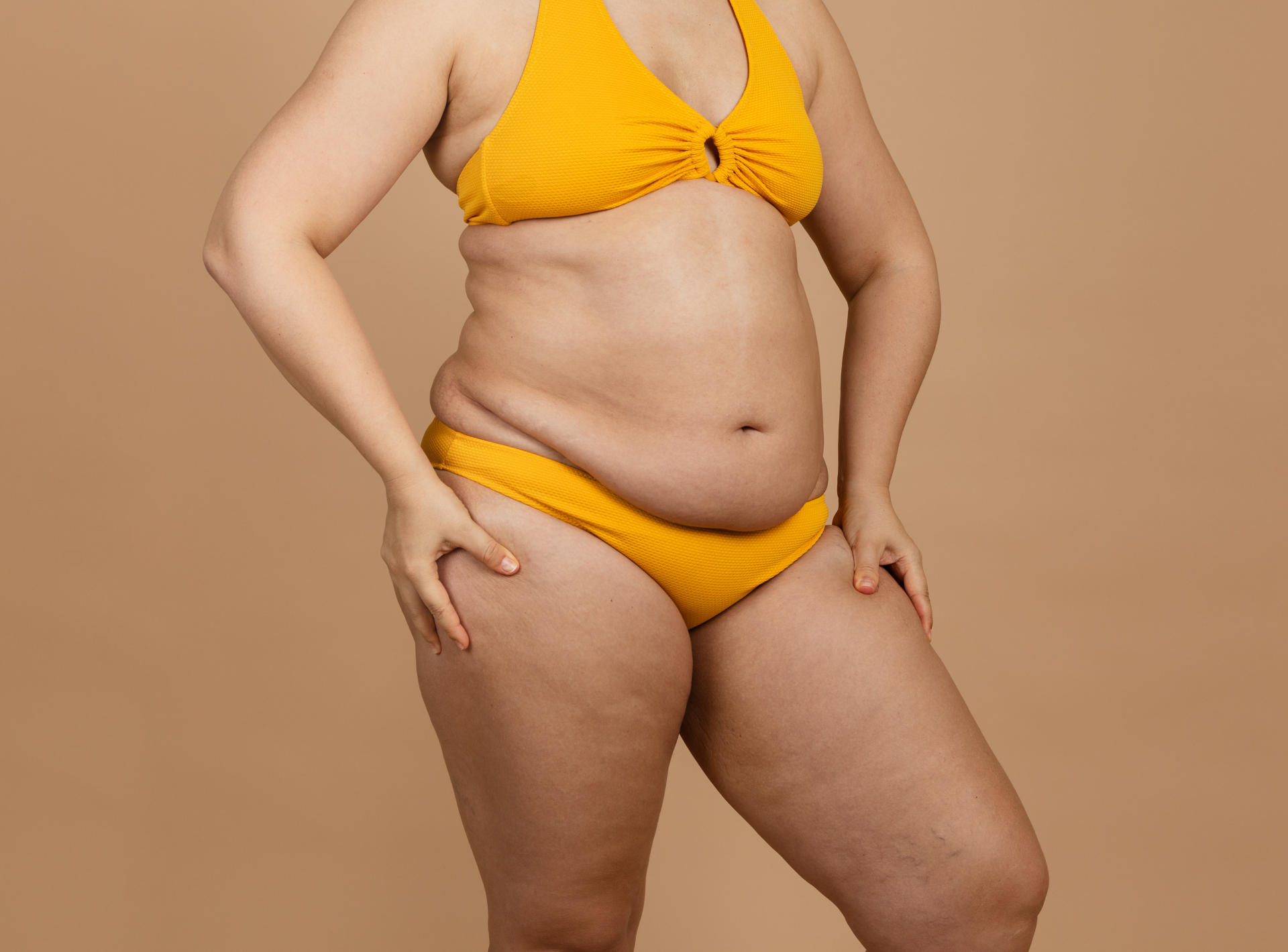 Laser Liposuction Results