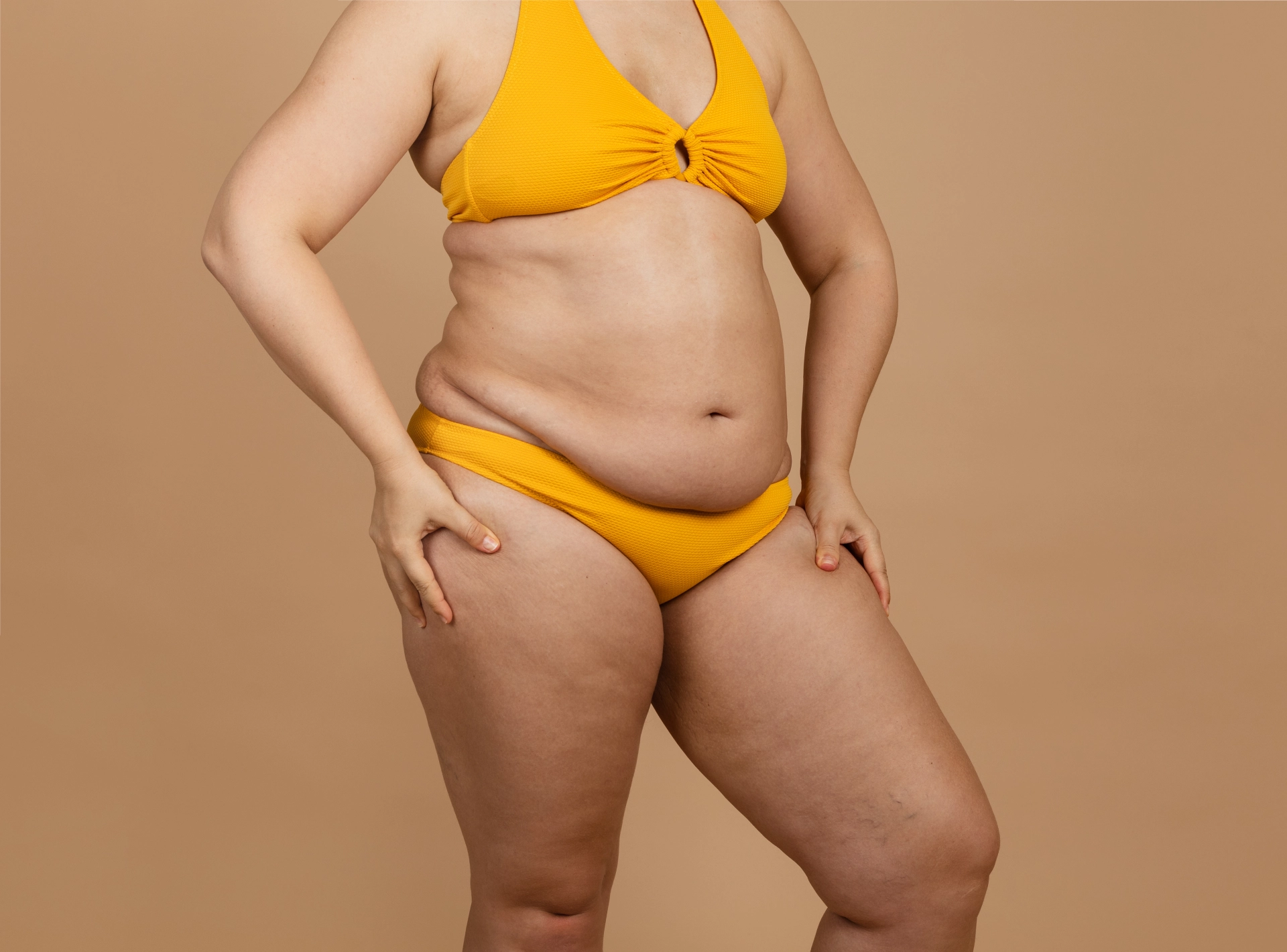 How Soon Will I See Liposuction Results?