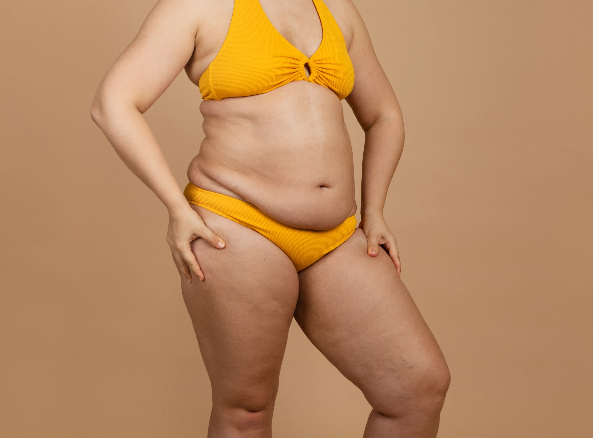 What is the Ideal Weight for Liposuction?