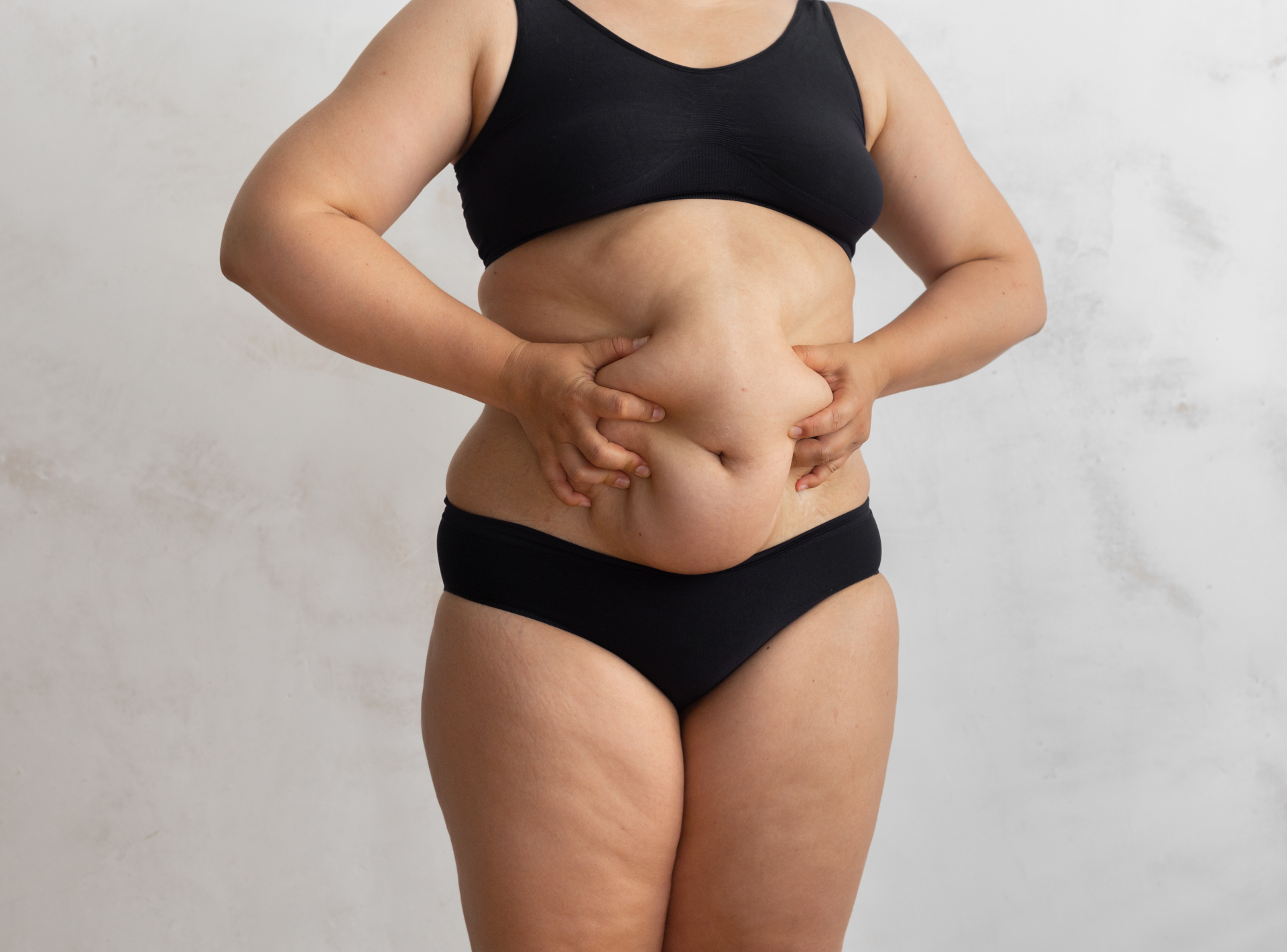 Liposuction or Tummy Tuck?