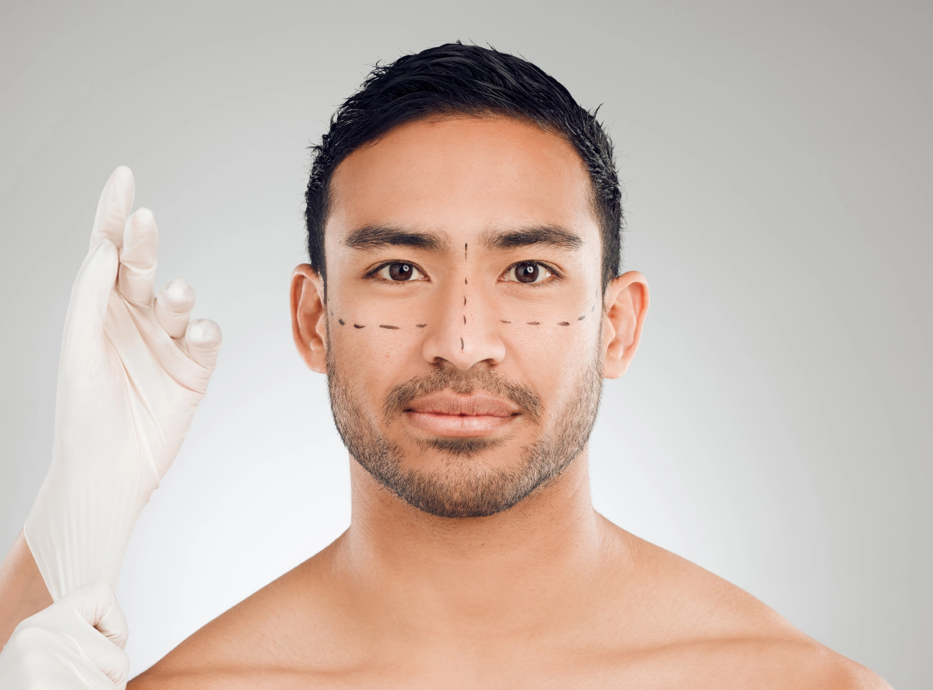 Natural Looking Male Facelifts with Dr. Perfect Celebrity