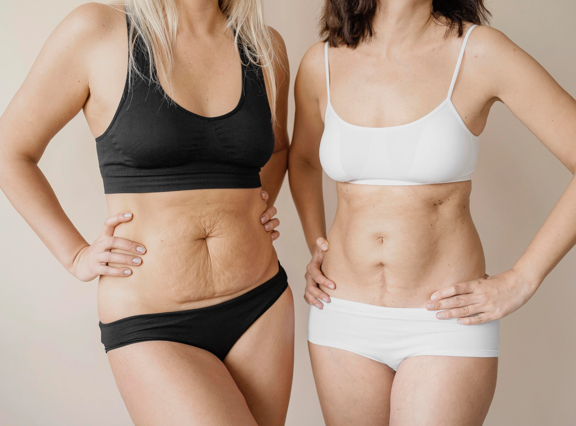 Mini Tummy Tuck Vs Full Tummy Tuck Recovery Guide