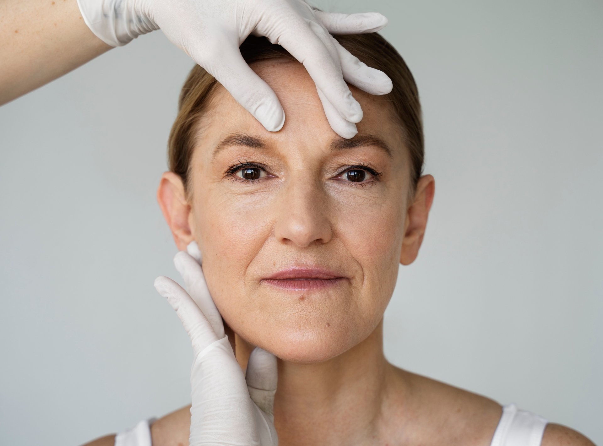 Expect from My Facelift