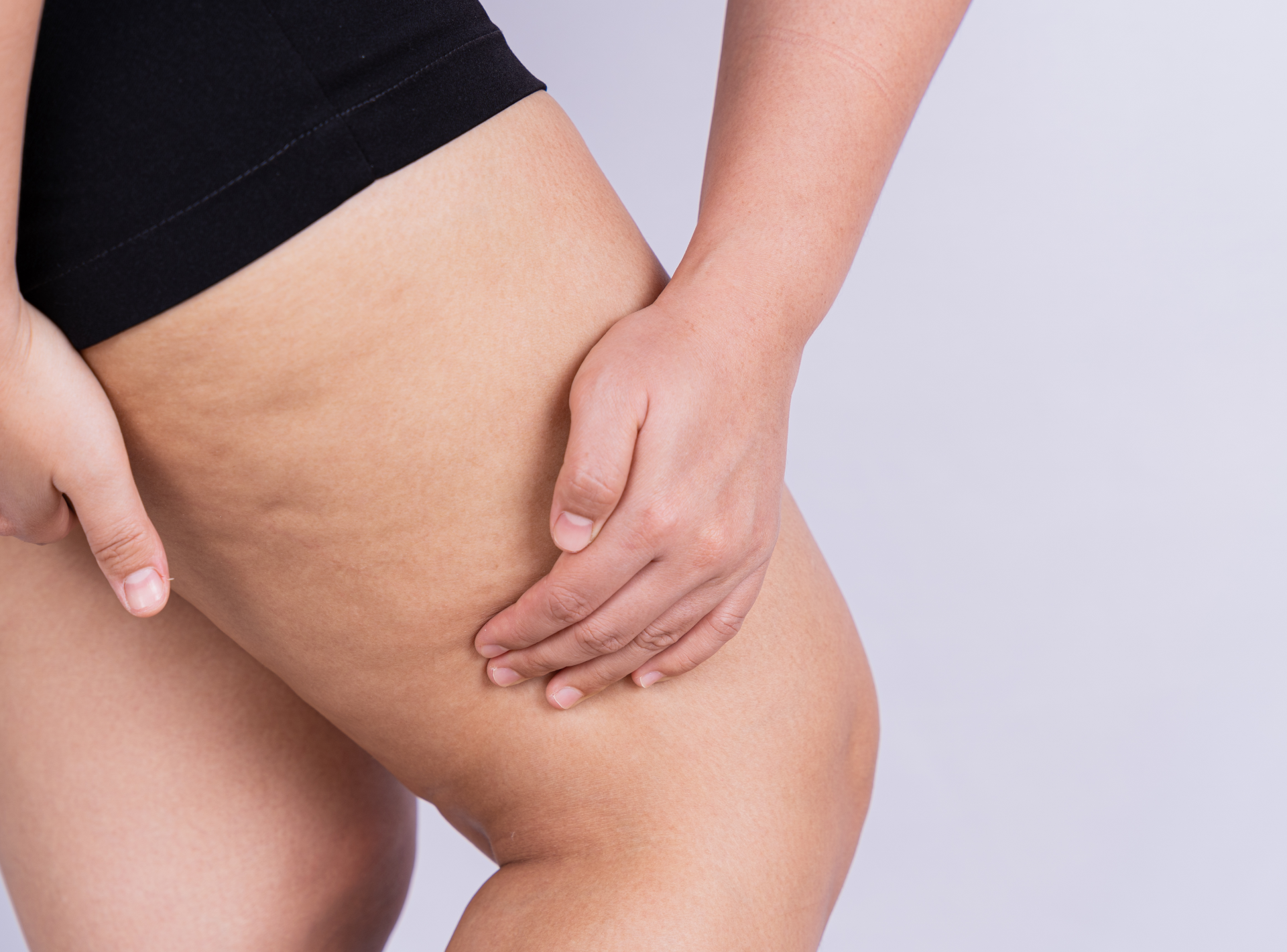 Non-surgical Method to Treat Cellulite