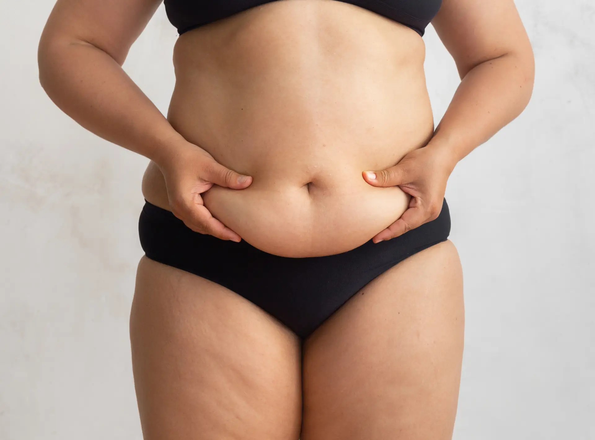 What Skin is Removed for a Tummy Tuck?