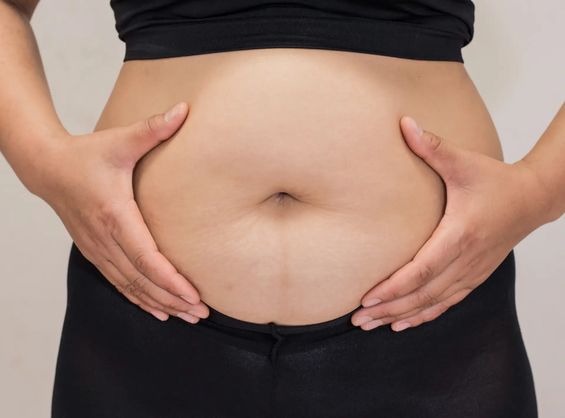 Scheduling Your Tummy Tuck
