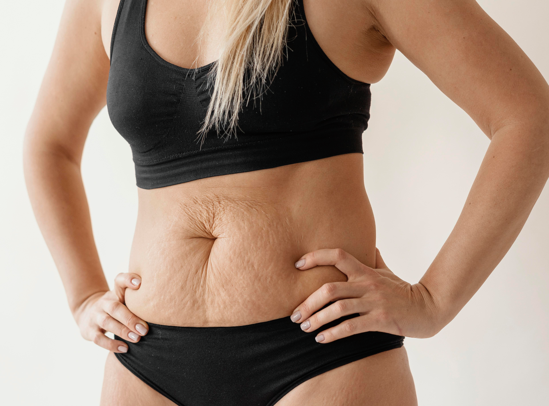 Can I Have Children After a Tummy Tuck?
