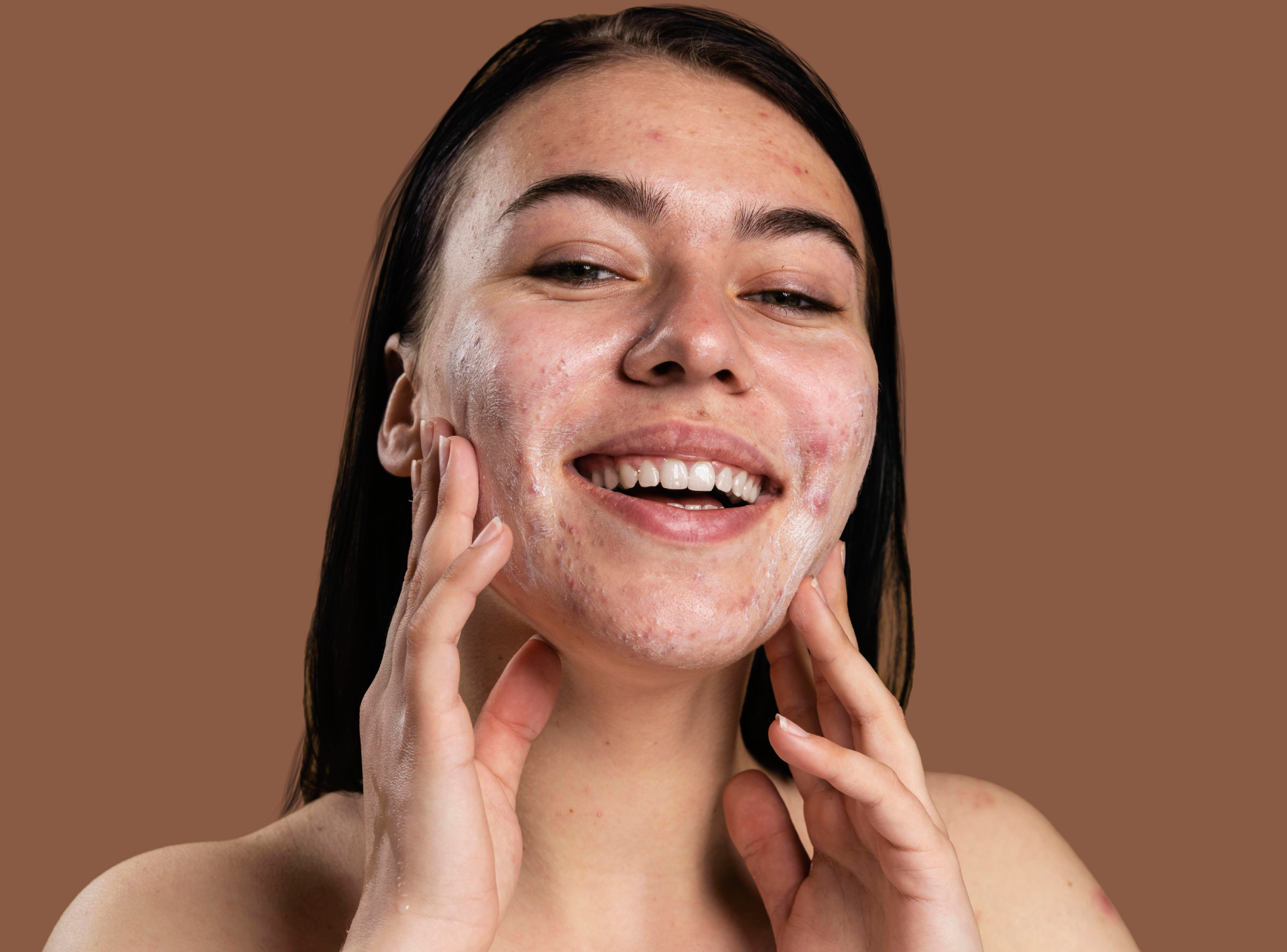 Main Acne Issues and How Deal with Them