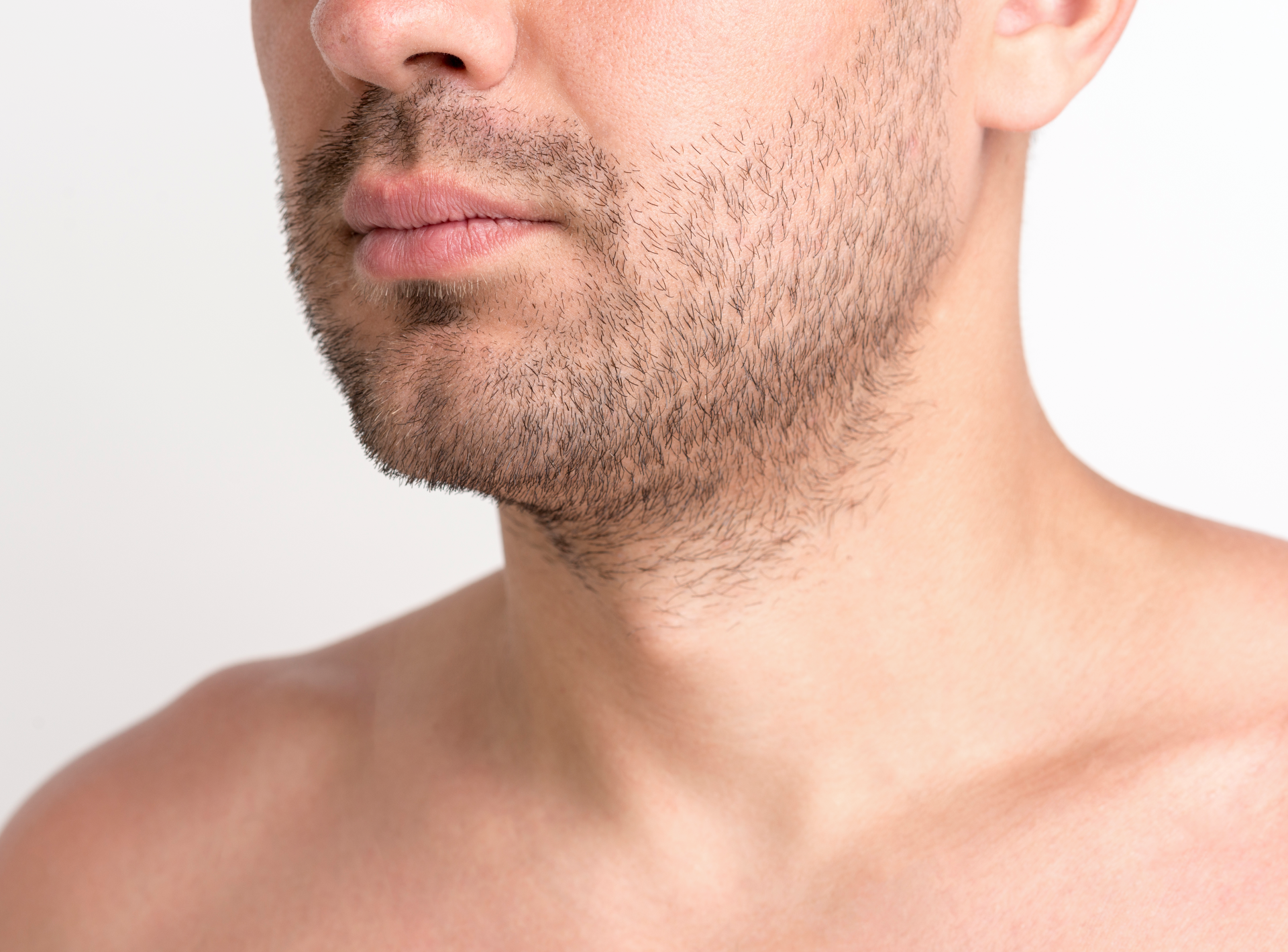 Beard Transplant Recovery Timeline