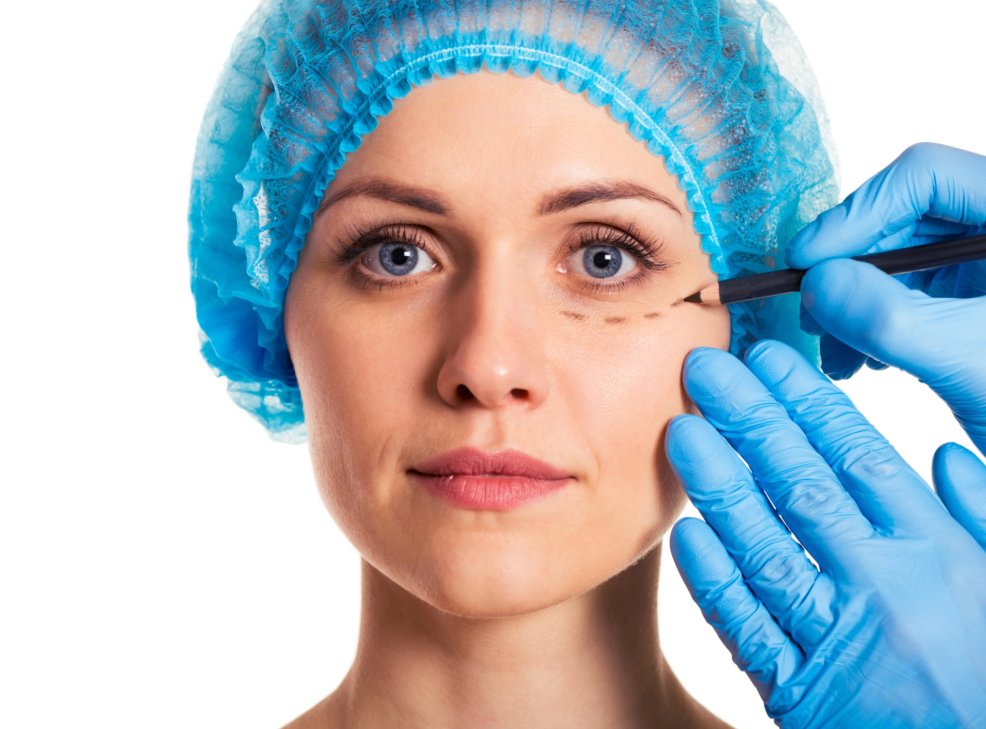 Blepharoplasty What to Expect