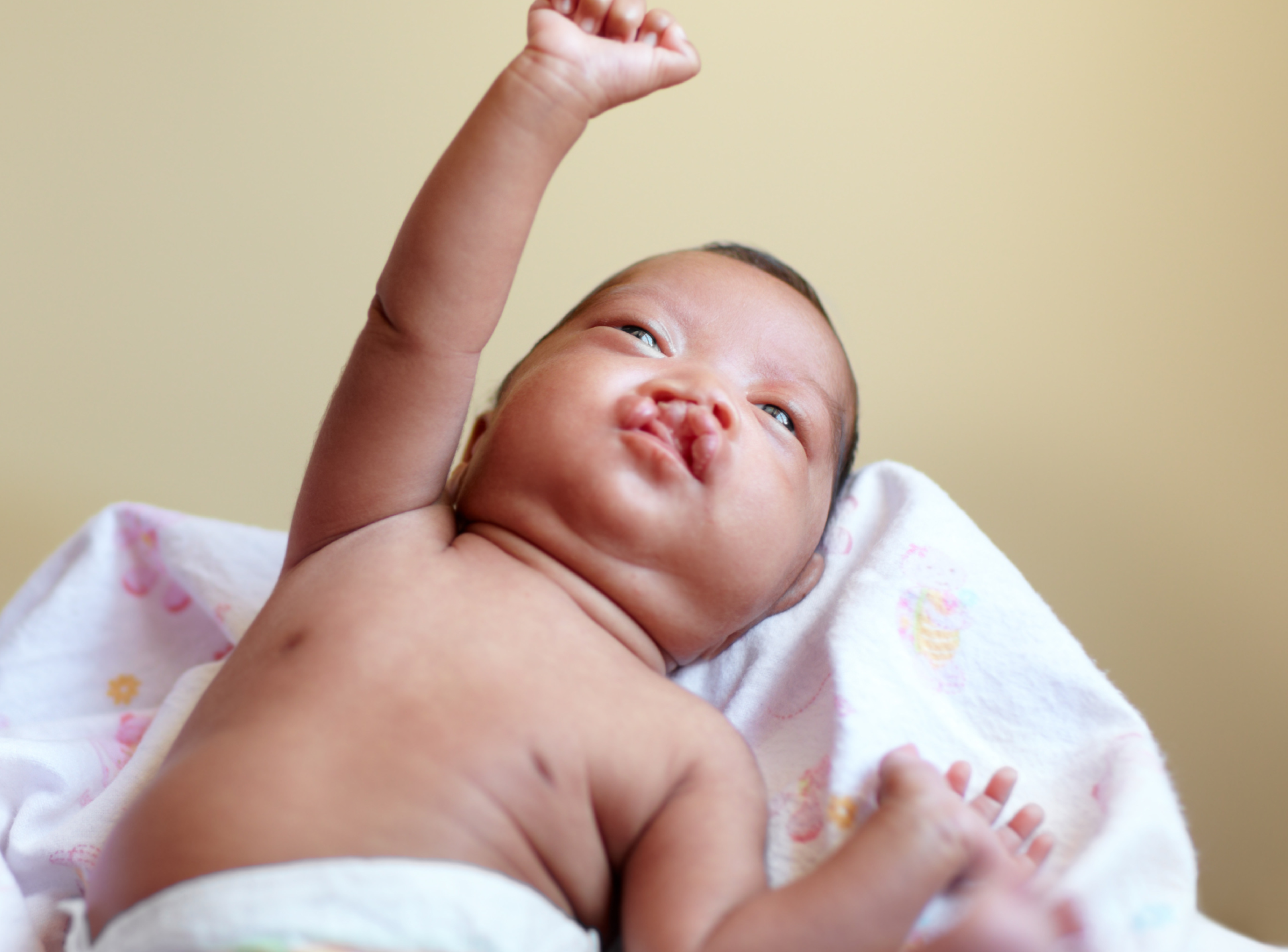 Frequently Asked Questions About Cleft Lip and Cleft Palate