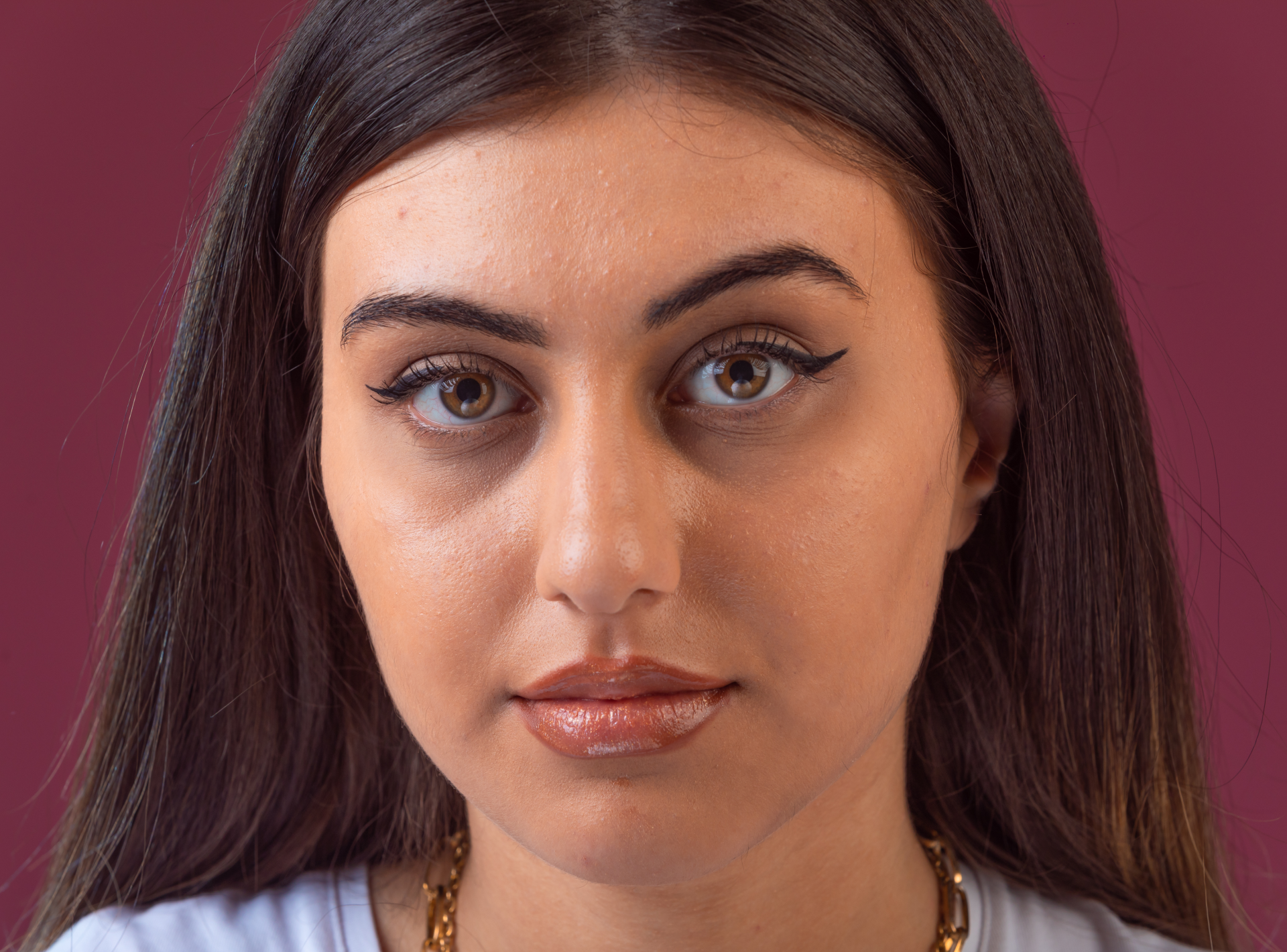 Dark Eye Circle Treatment Faqs