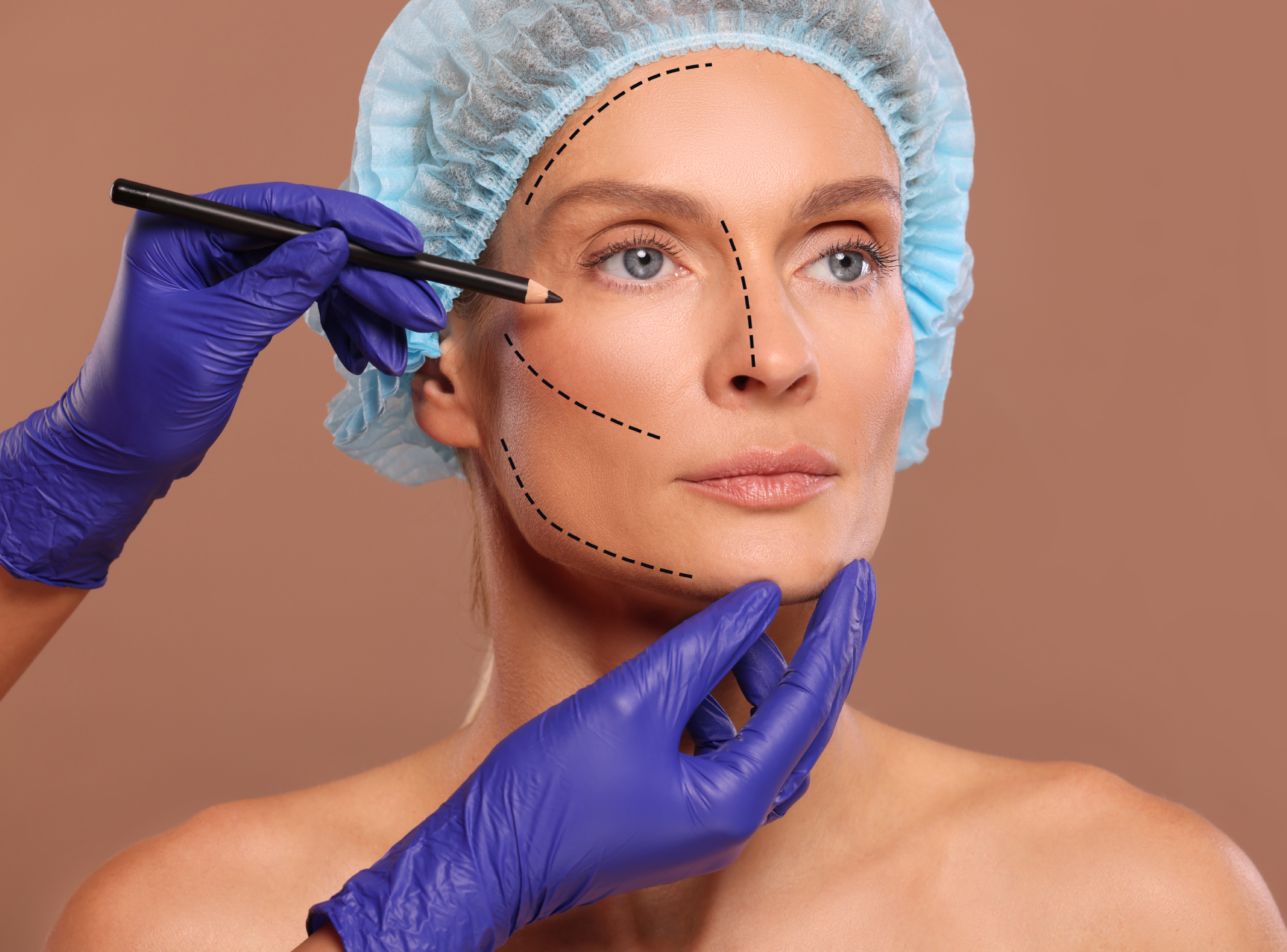 Best Age for a Facelift