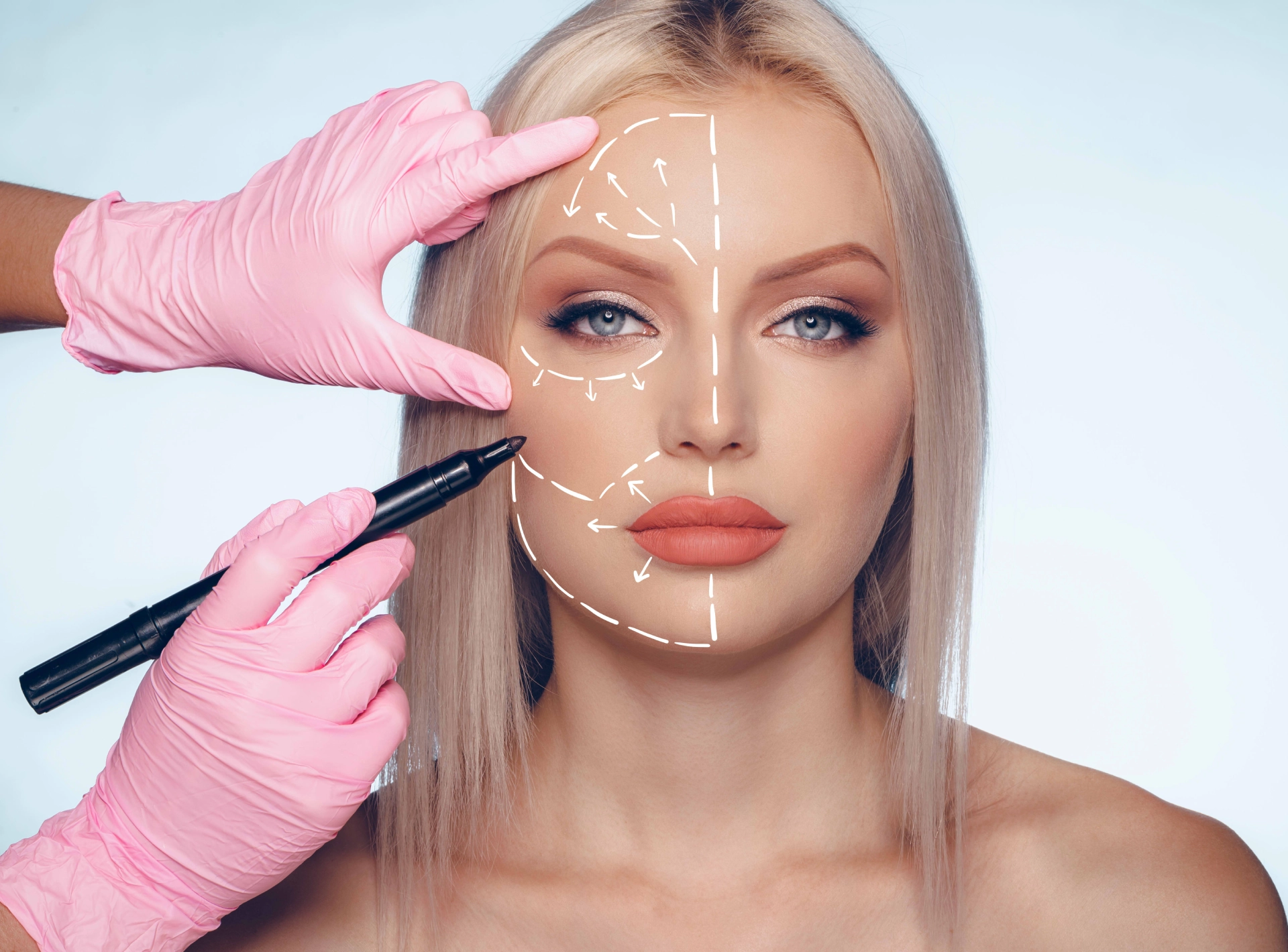 Facelift Vs Fillers How to Decide