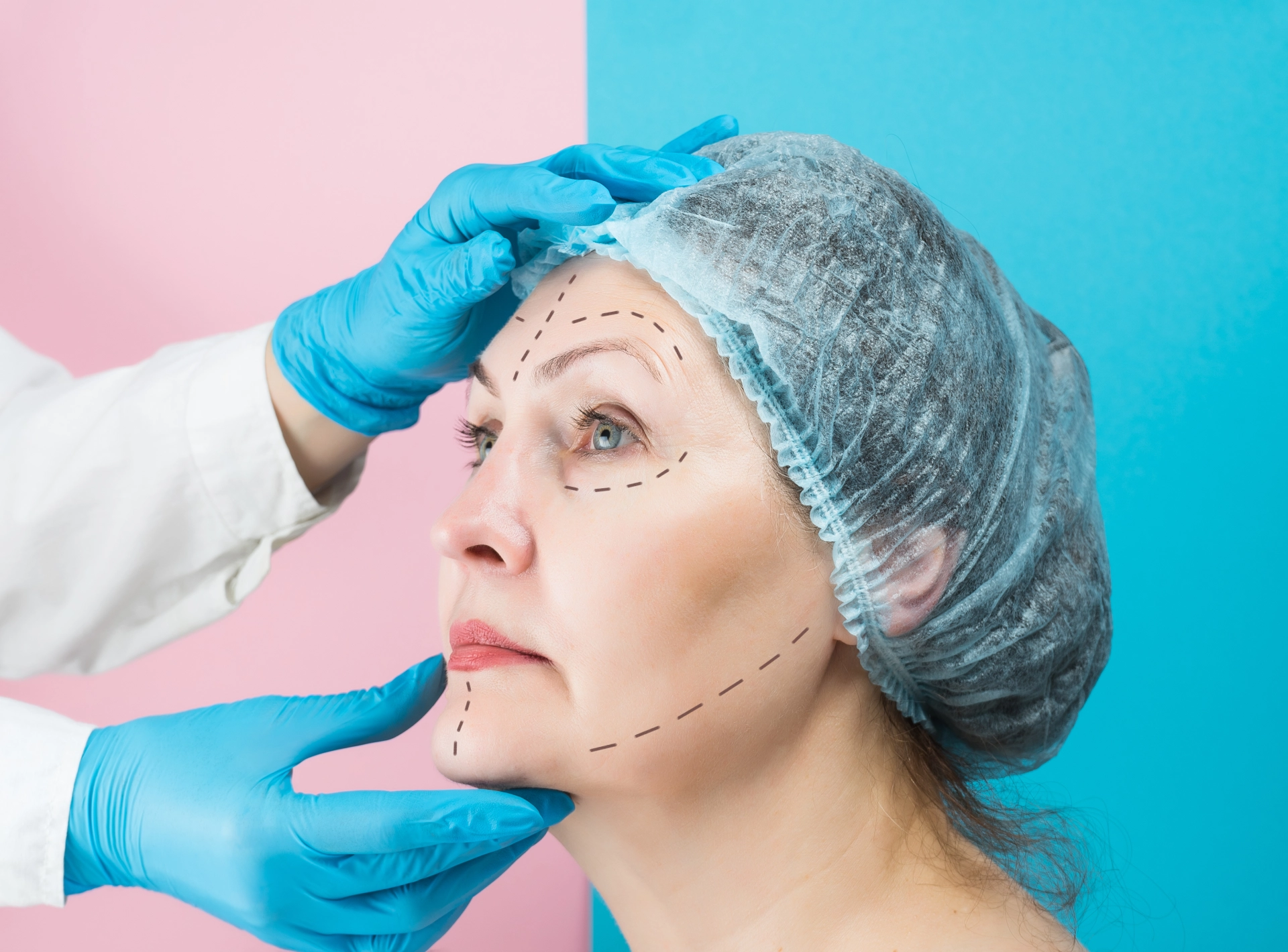 the Different Types of Facelifts Explained