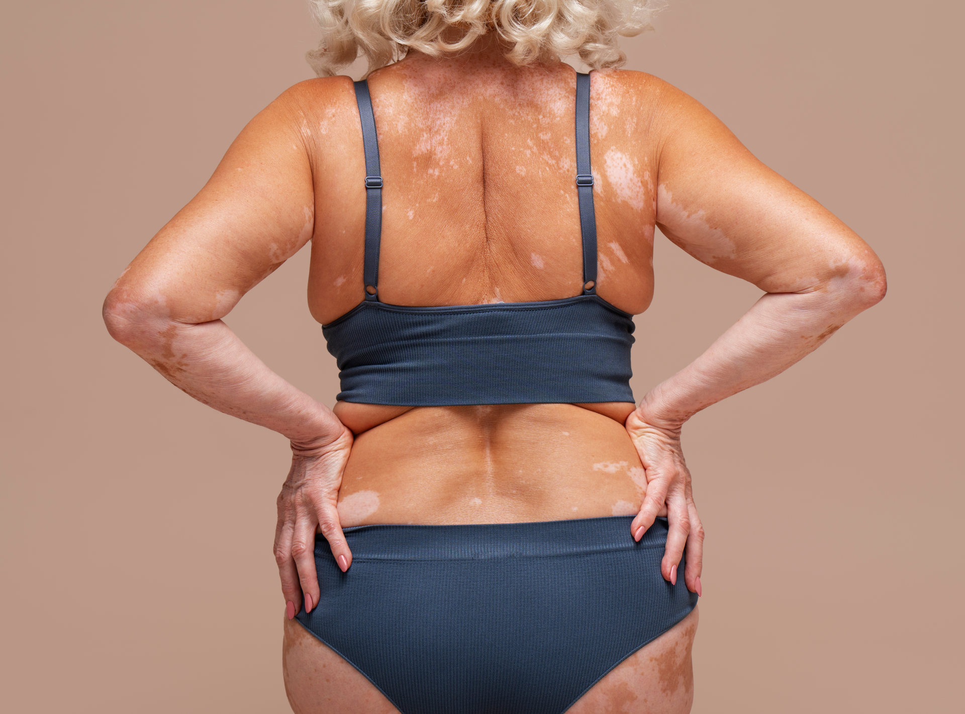 Female Back Liposuction Risks