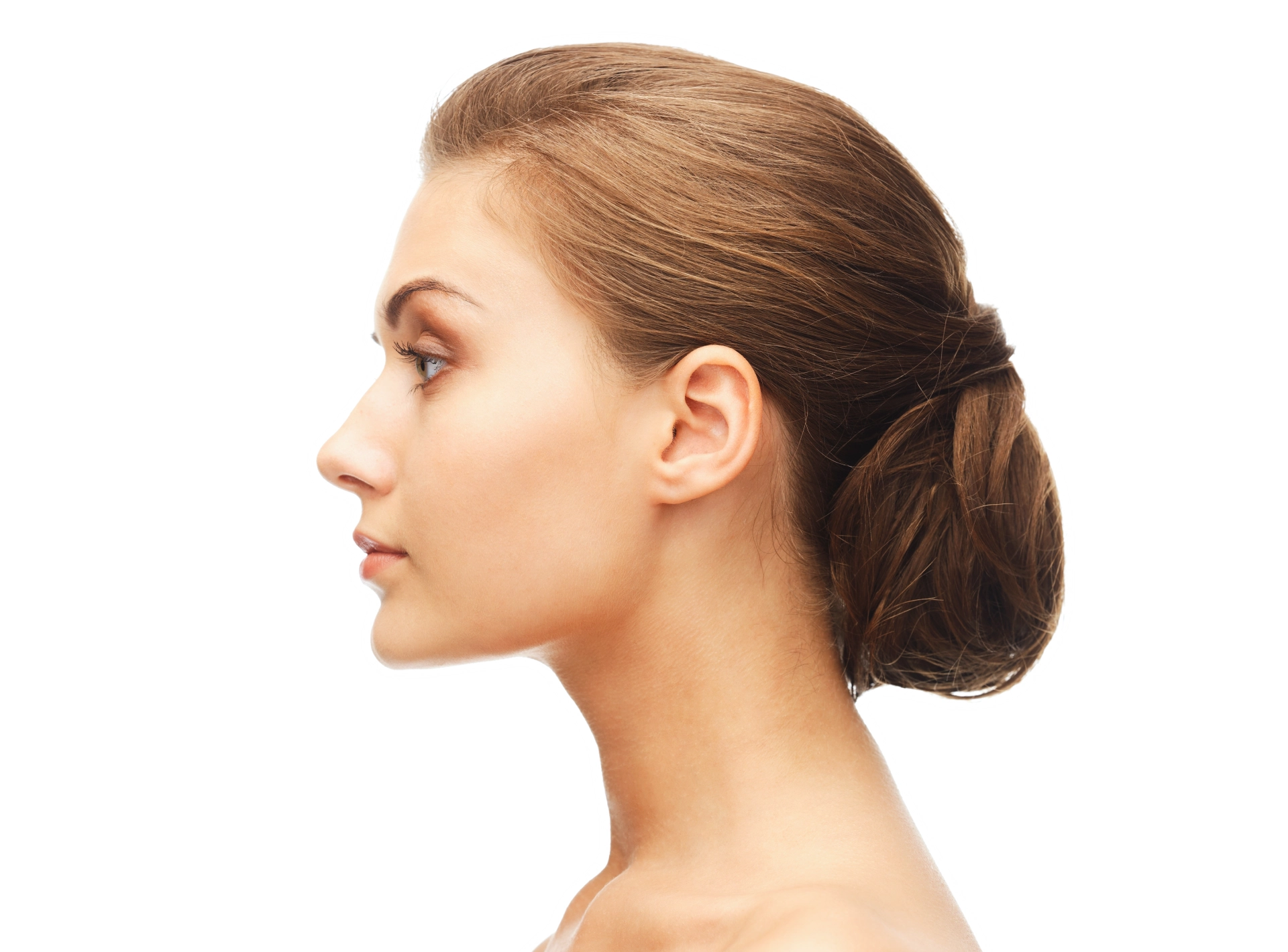 Genioplasty Maintenance and Results