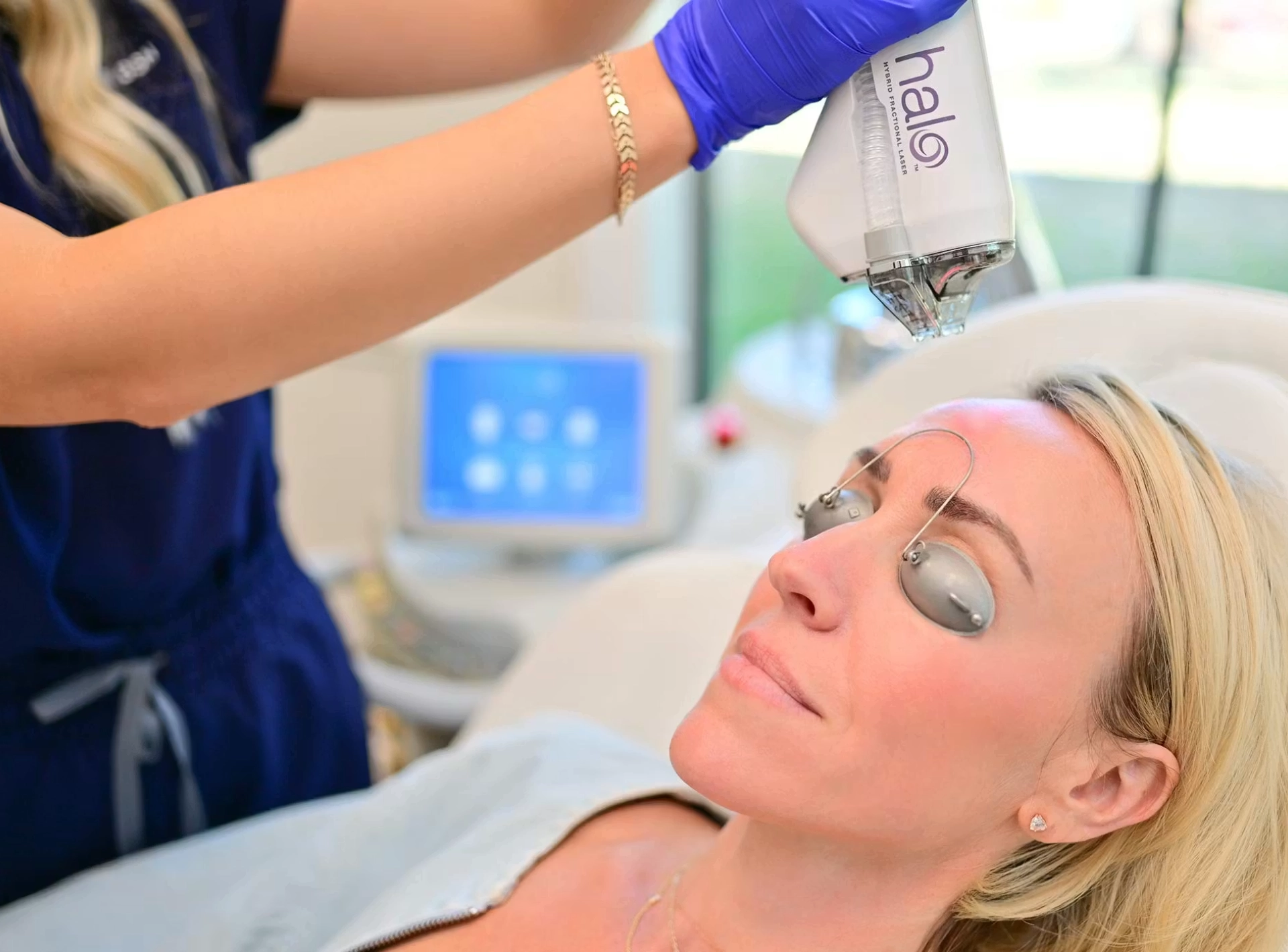 5 Questions to Ask About the Halo Hybrid Fractional Laser Treatment
