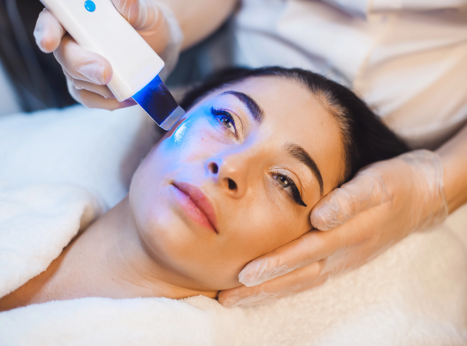 Can You See Results After 1 Ipl Session What to Expect