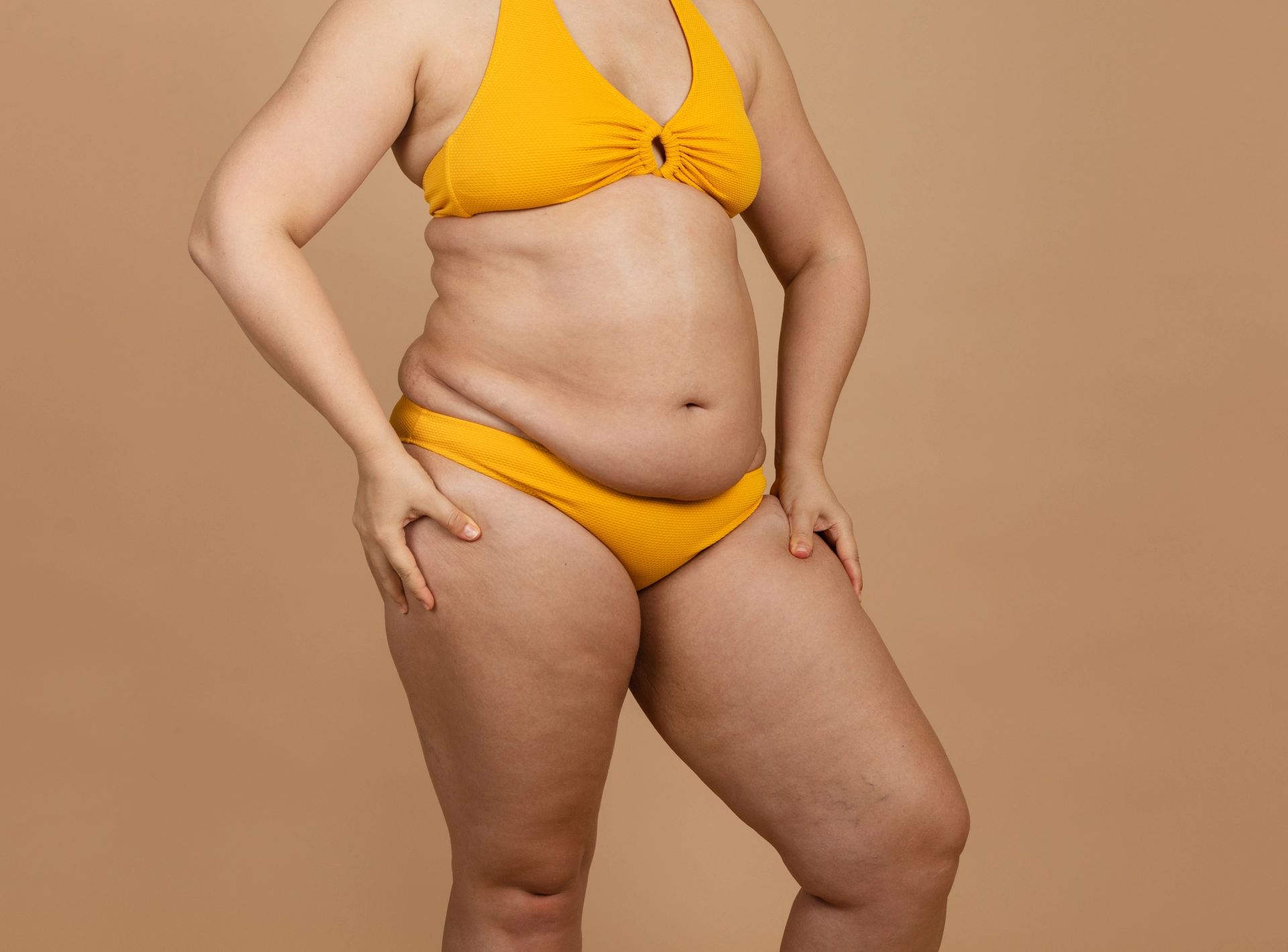 Liposuction Recovery Timeline and Healing Stages