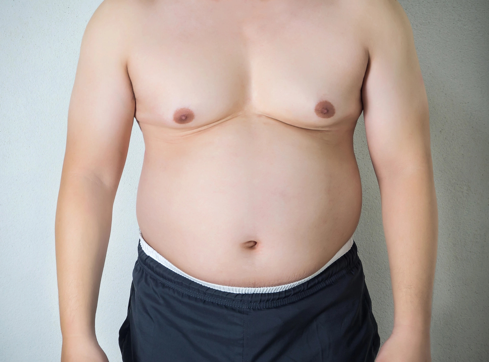 Top Reasons to Consider Male Breast Reduction Surgery