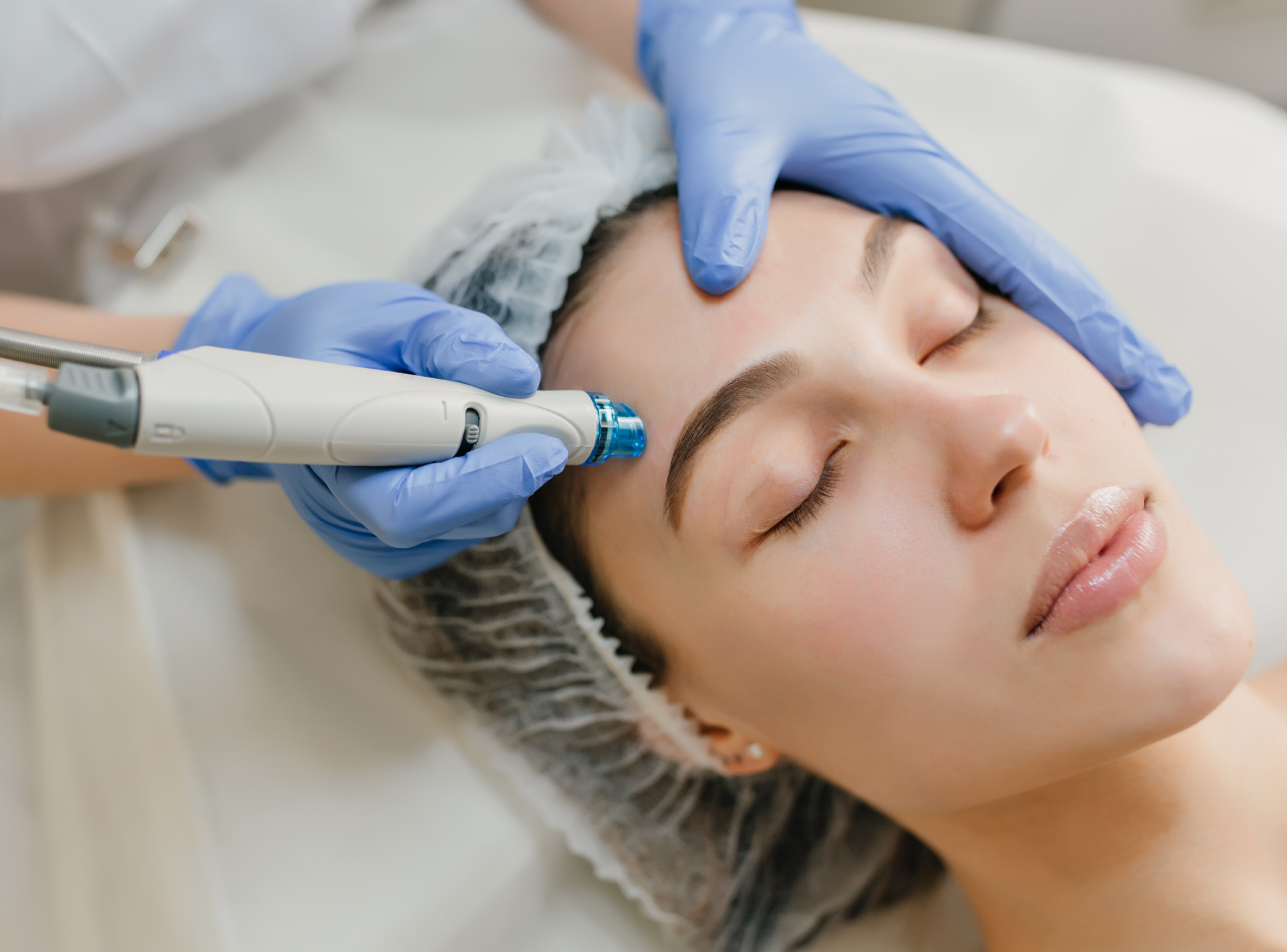 Benefits of Microneedling for Skin