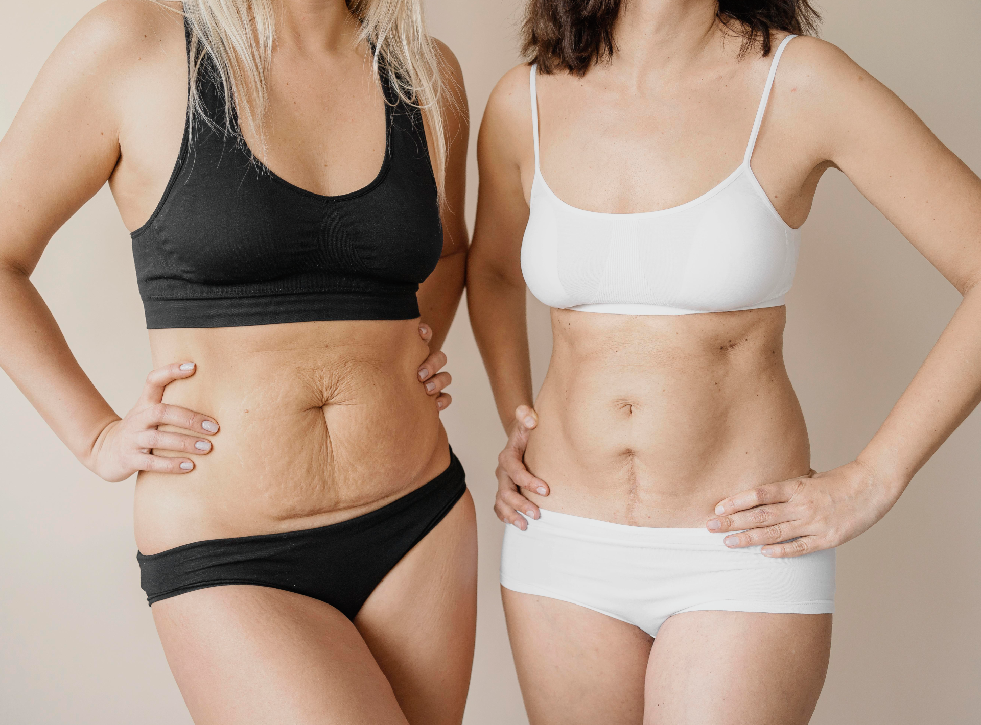 Scheduling Your Mommy Makeover