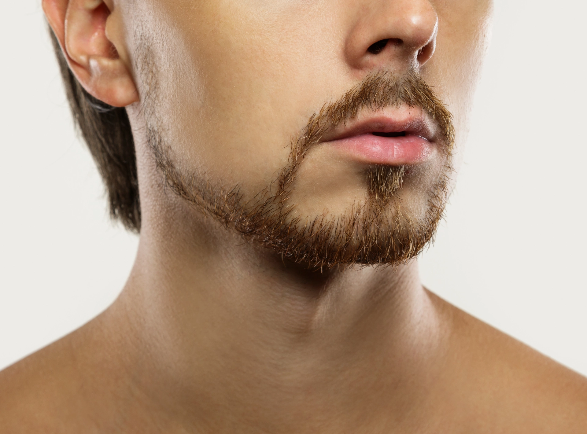 Moustache Transplant Results: 2–6 Month Recovery Timeline