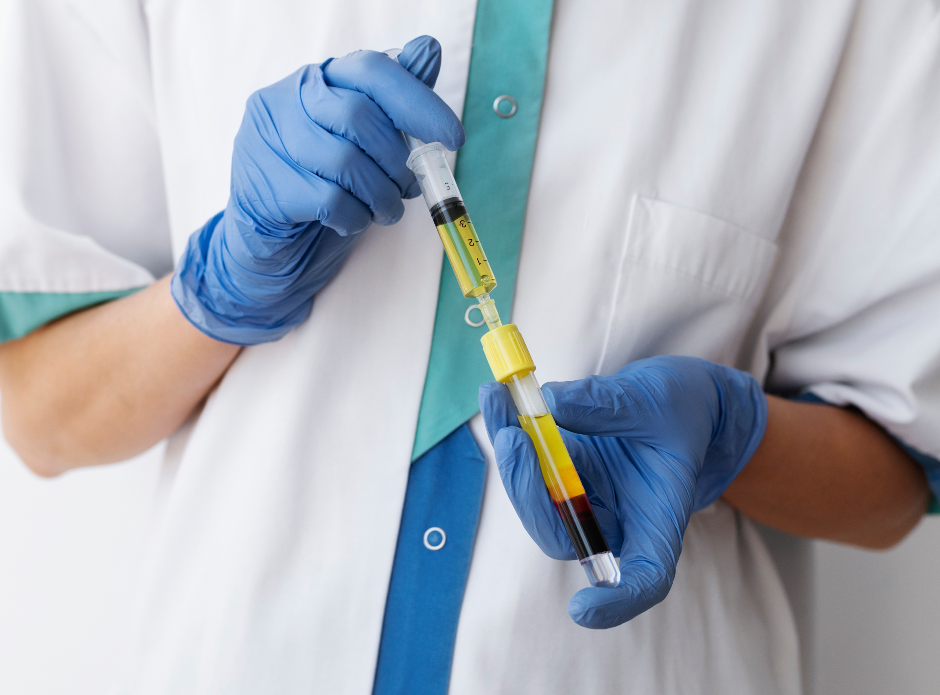 Questions About Prp Injections Answered