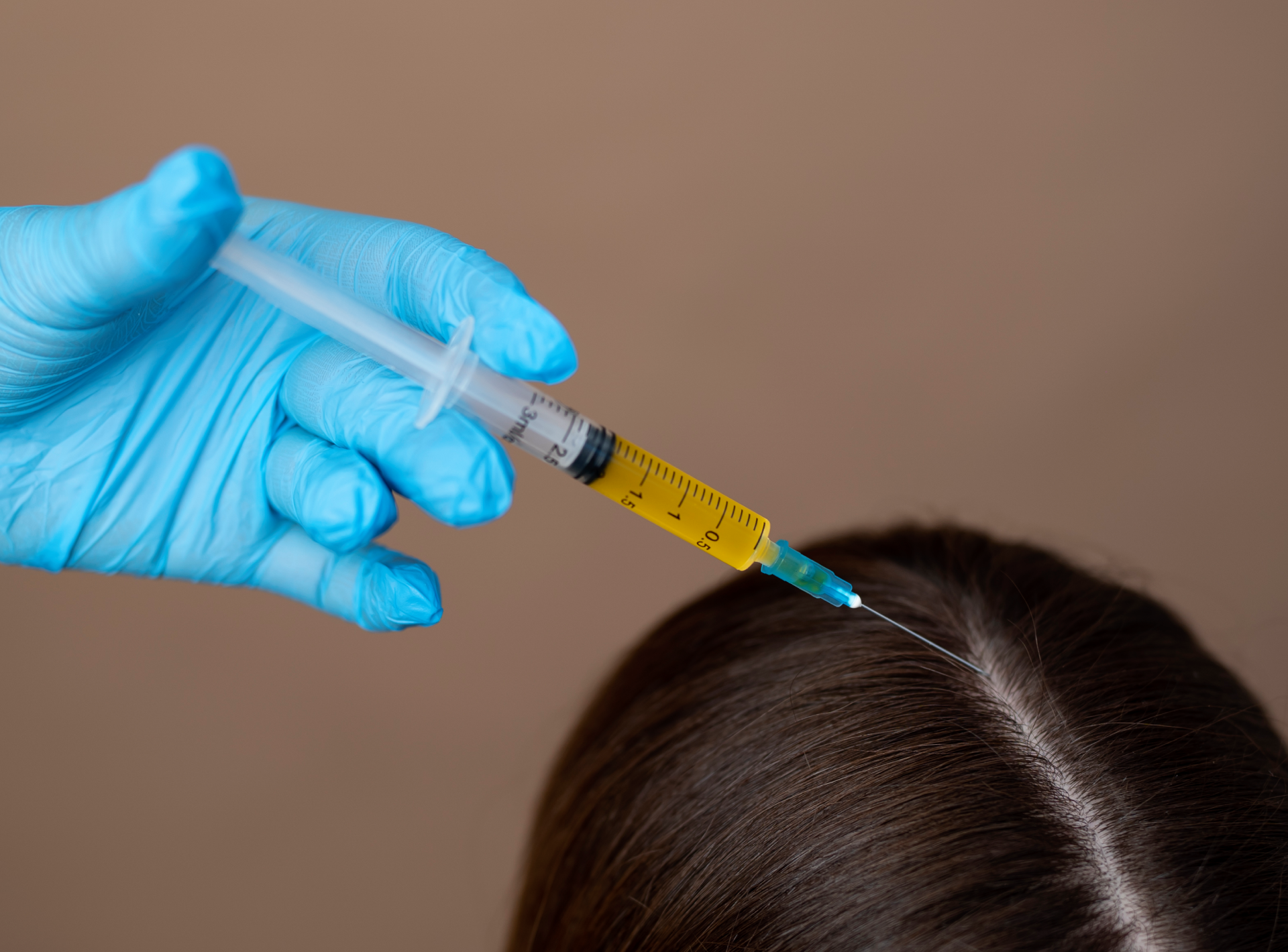Questions to Ask Choosing a Prp Provider