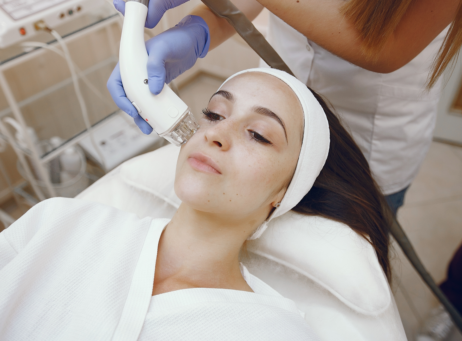 Rf Microneedling Results Timeline
