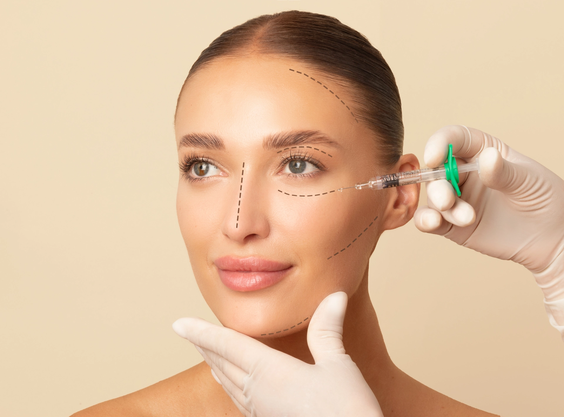 Sculptra Timeline: Understanding the Gradual Transformation Process
