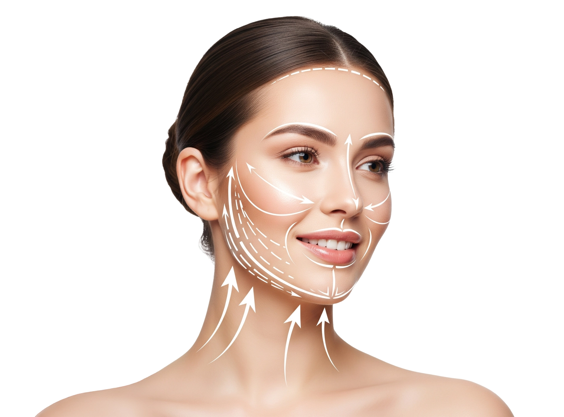 7 Questions About Thread Lift Treatment