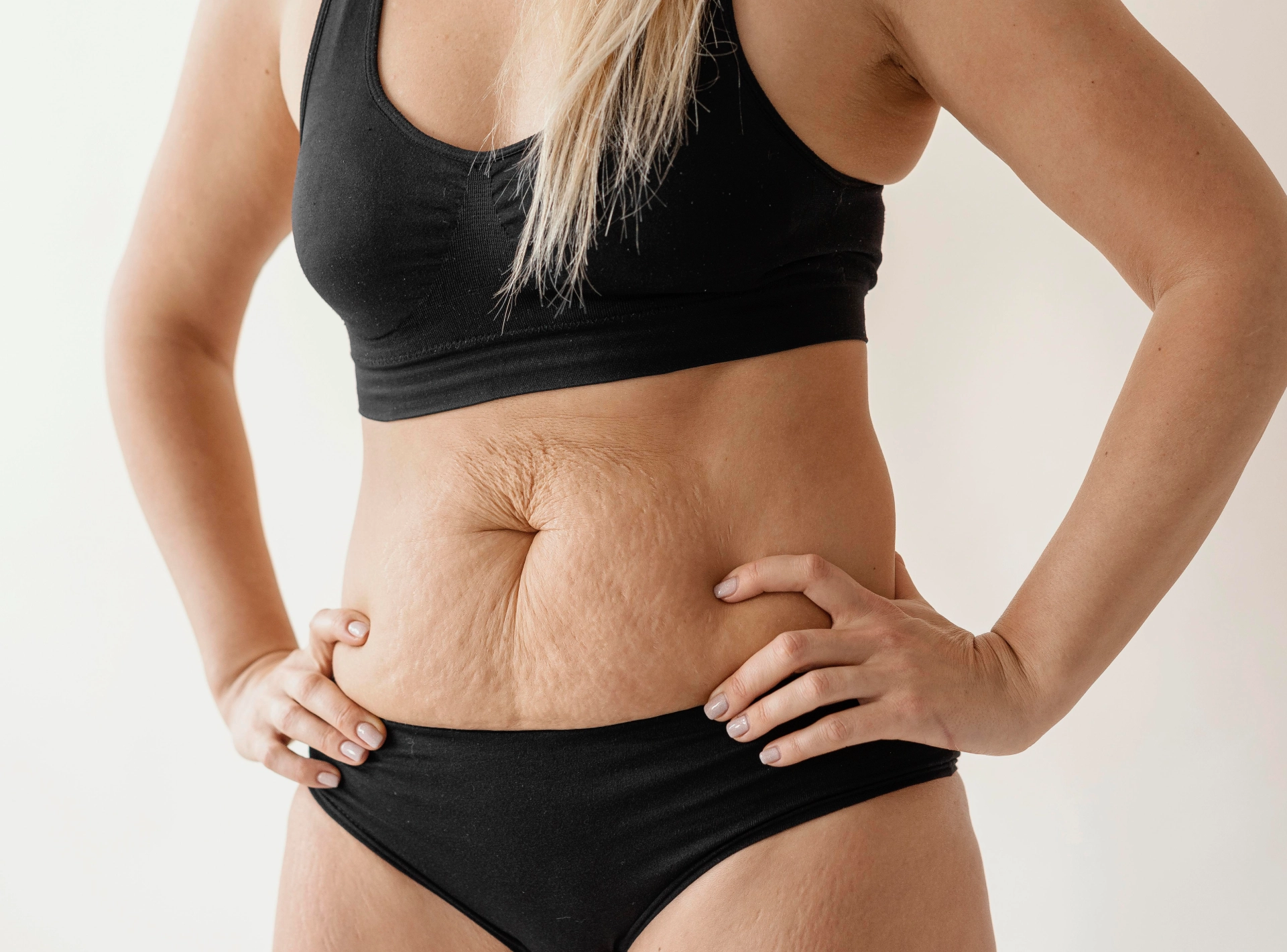the Secret Benefits of a Tummy Tuck