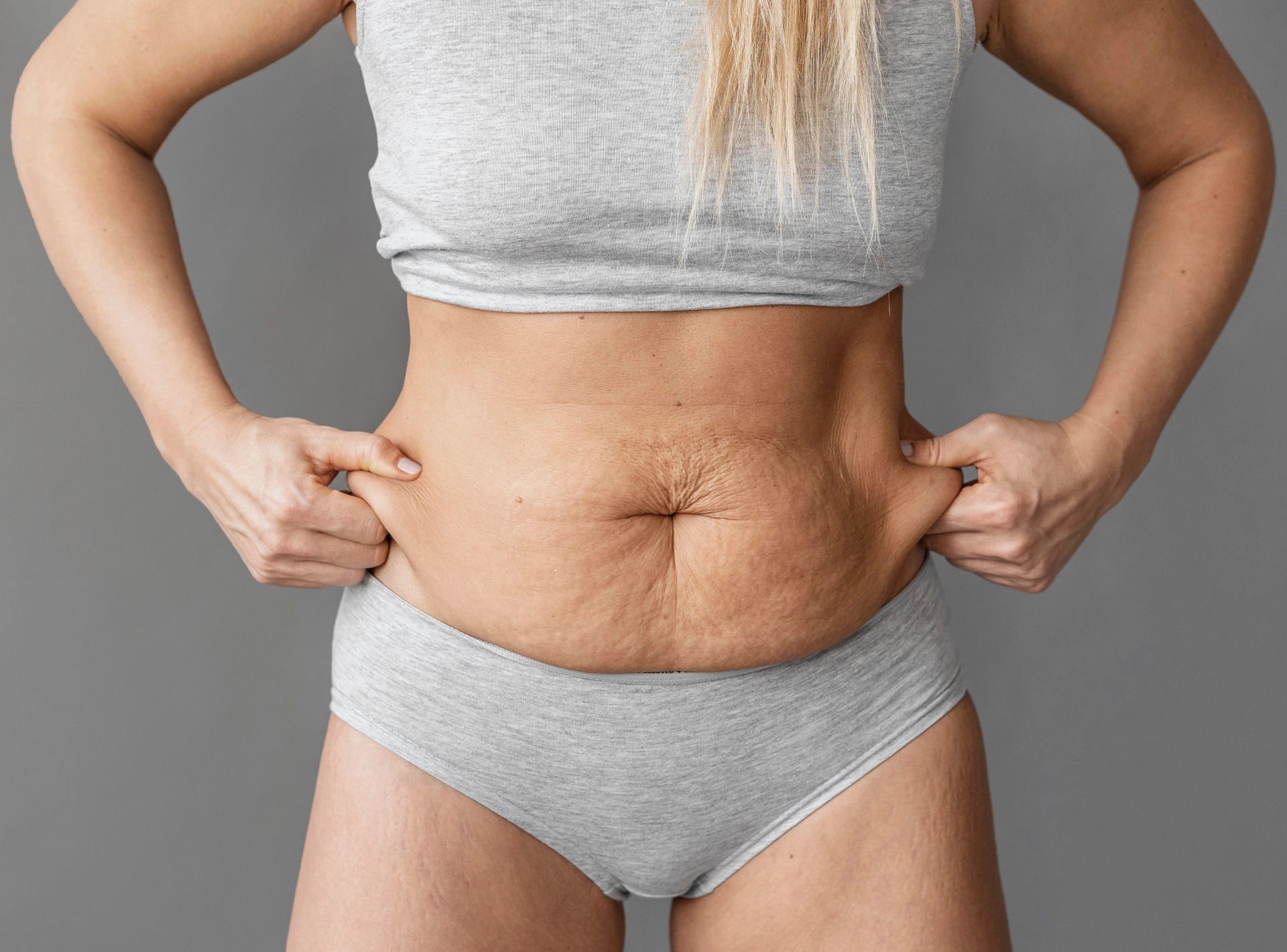 Medical Side of Confidence the Science Behind a Tummy Tuck