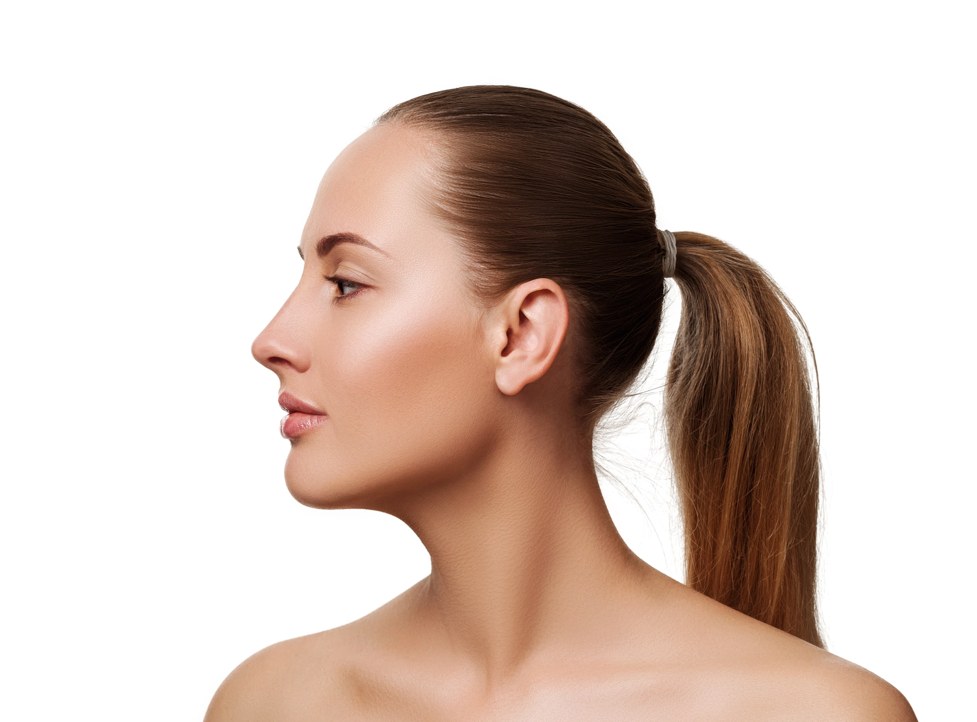 After Chin Implant