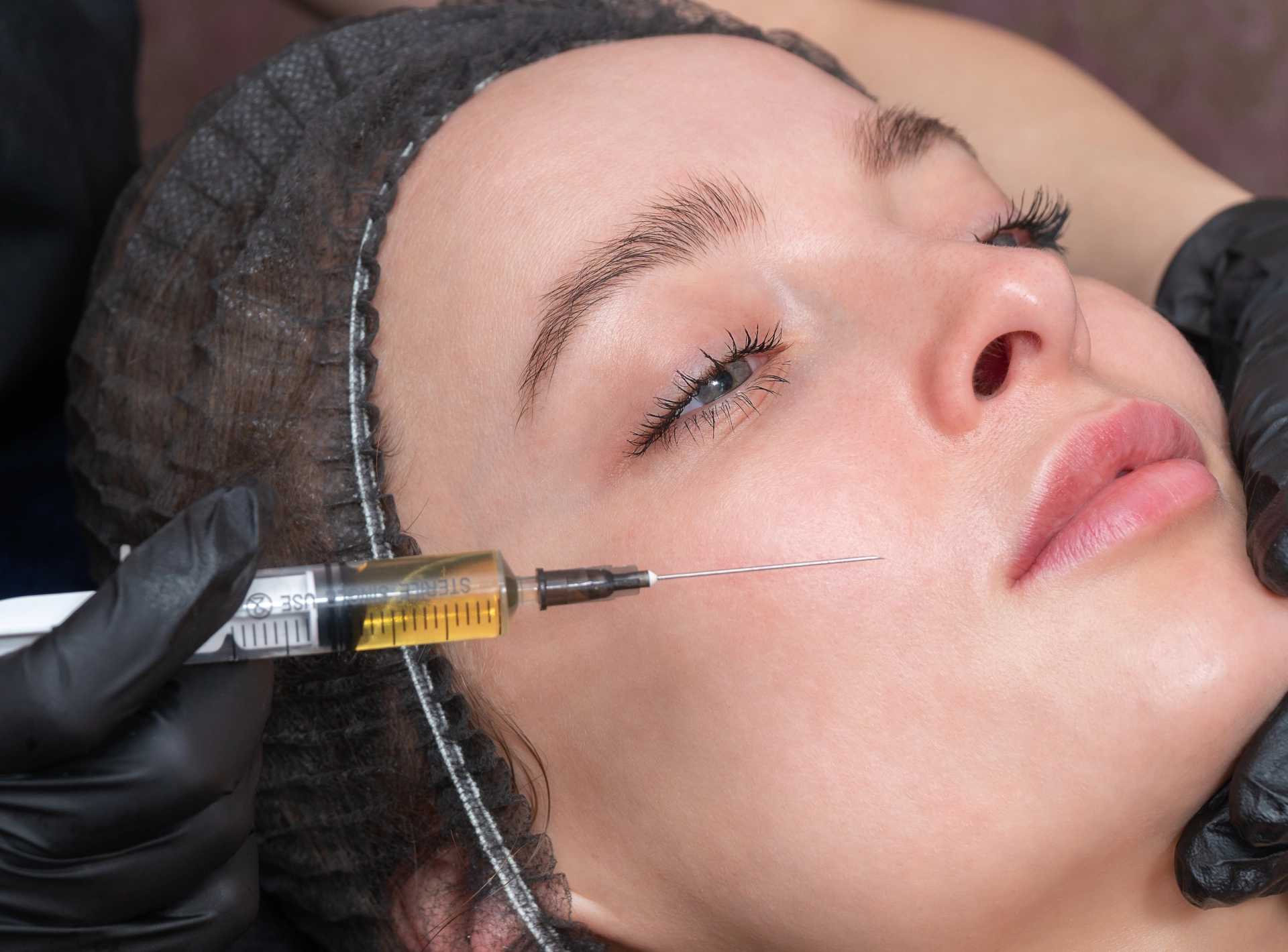 Prp Therapy Common Questions