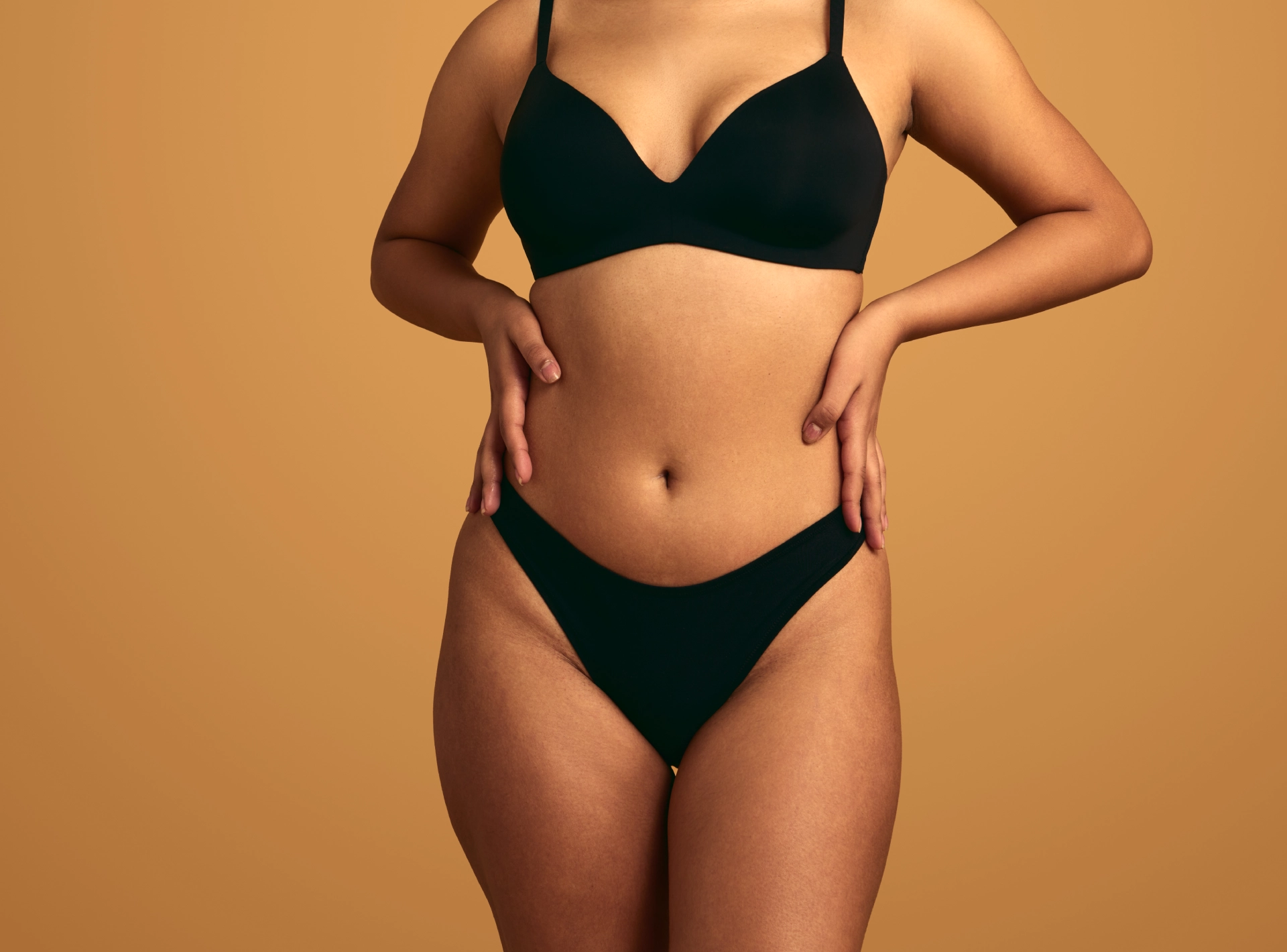 Tummy Tuck for Stretch Marks
